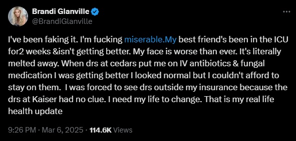 Brandi Glanville face update