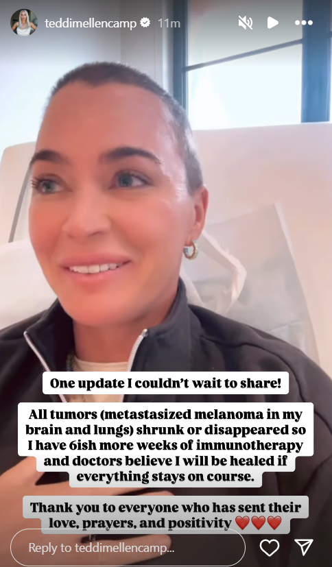 Teddi Mellencamp via her Instagram Story 